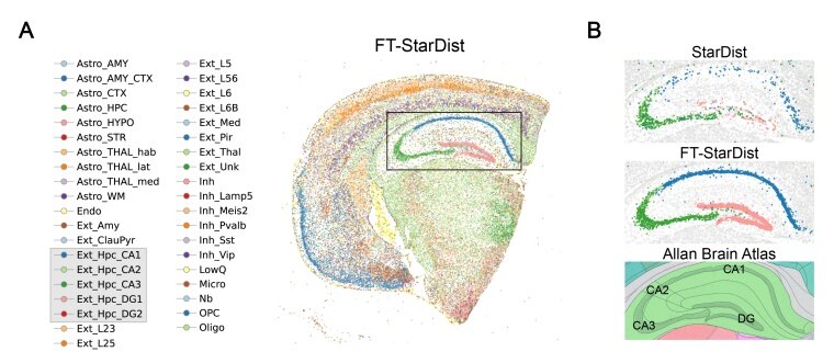 CSRefiner: A lightweight framework for fine-tuning cell segmentation ...