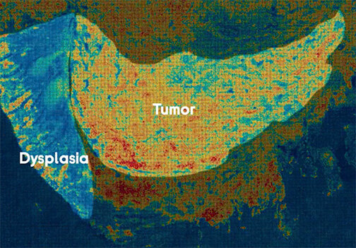 Transcriptomics Solution - STOmics